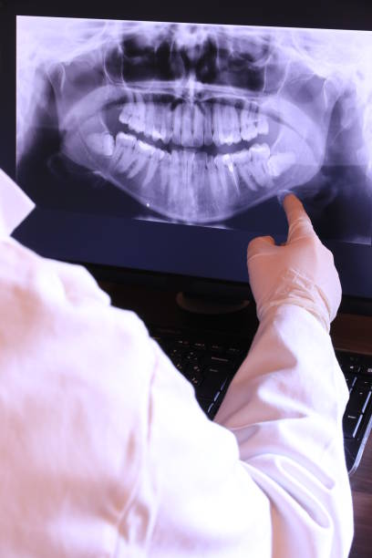 Best Emergency Wisdom Tooth Extraction in Gloucester, MA